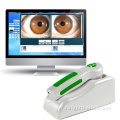 눈 테스트 기계 휴대용 iriscope iridology 스캐너 카메라